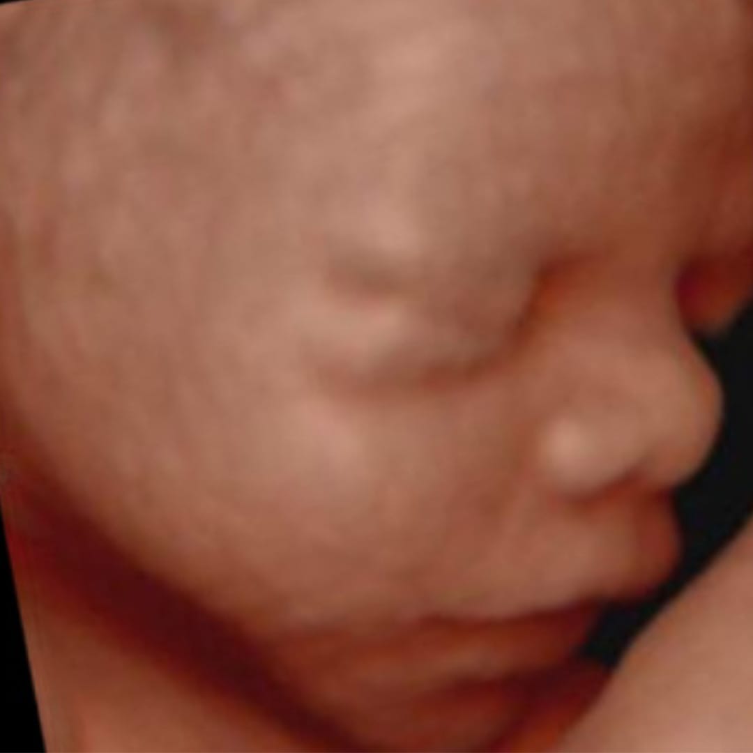 Before image
