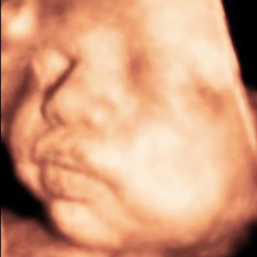 Before image