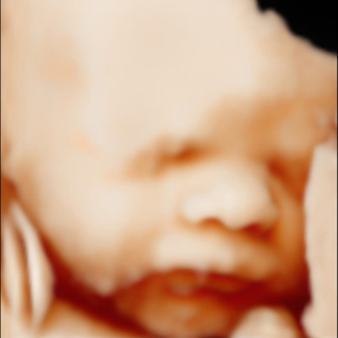 Before image