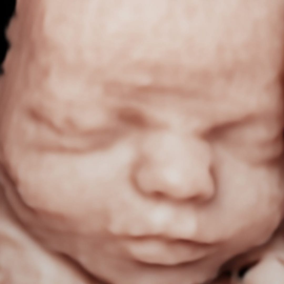 Before image